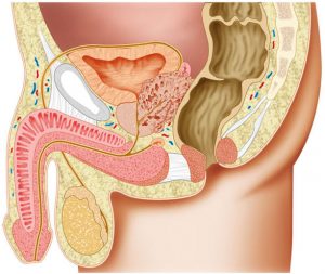 Prosztatamegnagyobbodás tünetei és kezelési módjai