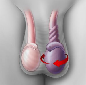 Az XP prosztatitis kezelésére szolgáló rendszerek normal prostate volume in grams